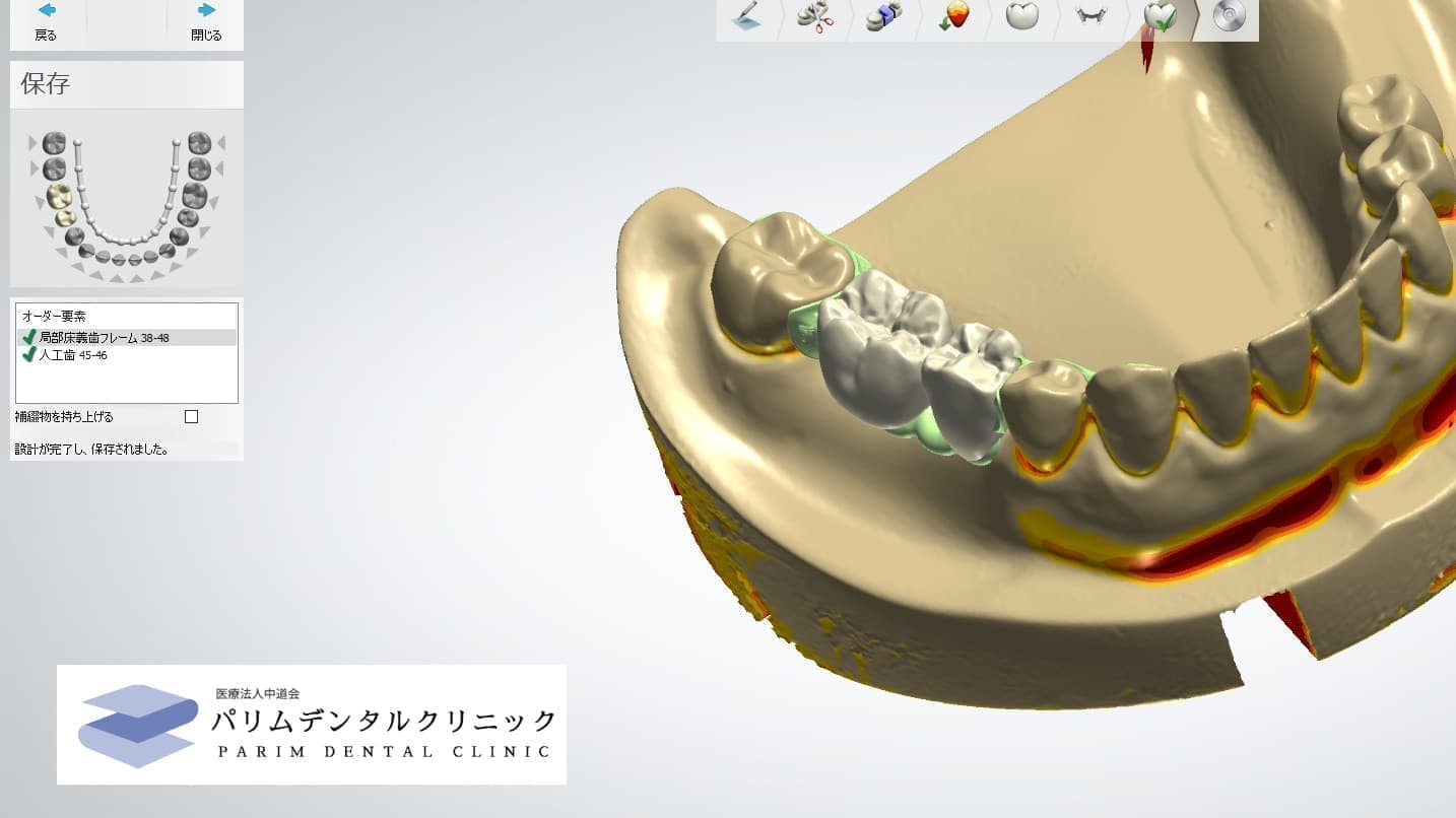 TRIOS3の3shape社のCAD/CAMソフト