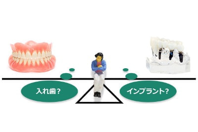インプラントか総入れ歯か