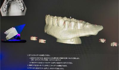 デジタル義歯