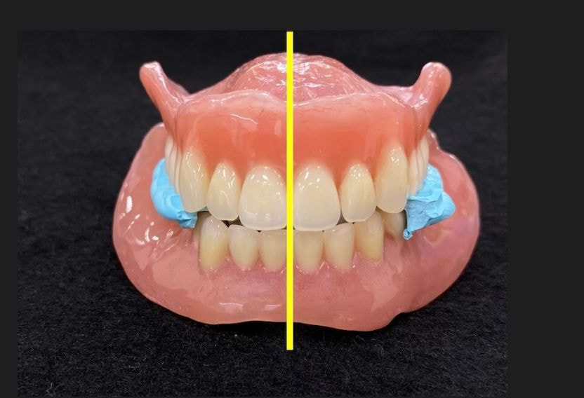 義歯の完成した写真