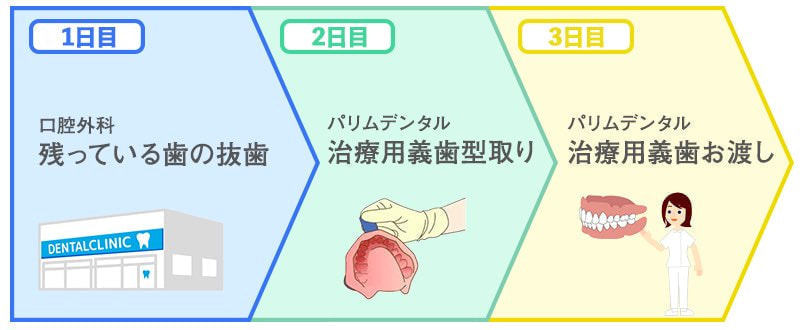 抜歯から入れ歯お渡しまでの流れ